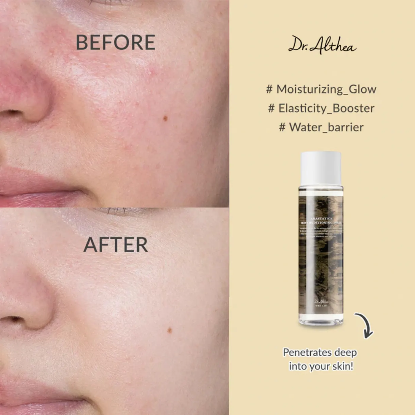 Dr.Althea Anastatica Skin Conditioning Toner 250мл — изображение 3