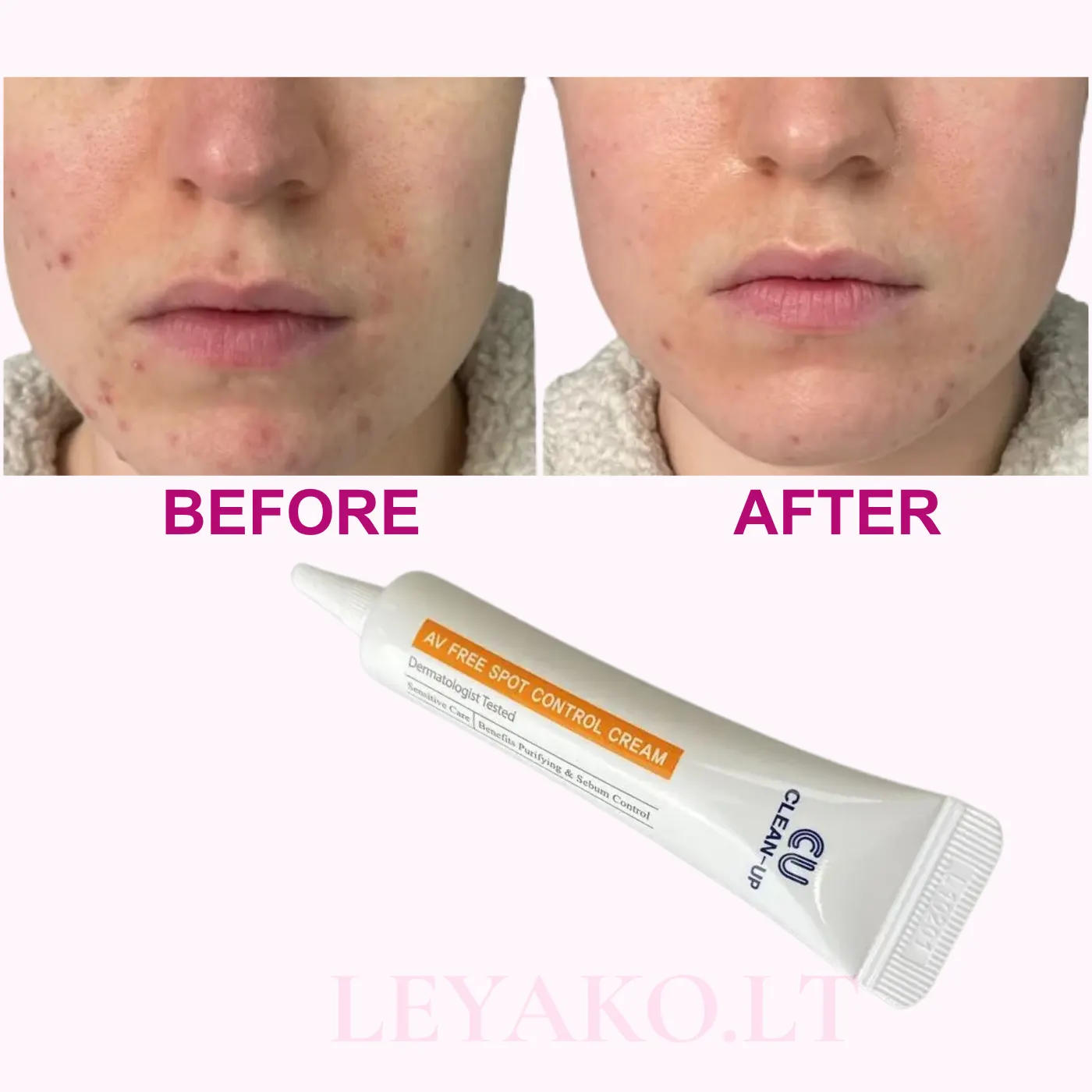 CUSKIN Clean Up AV Free Spot Control Cream/ Точечный крем для борьбы с комедонами 10мл — изображение 3