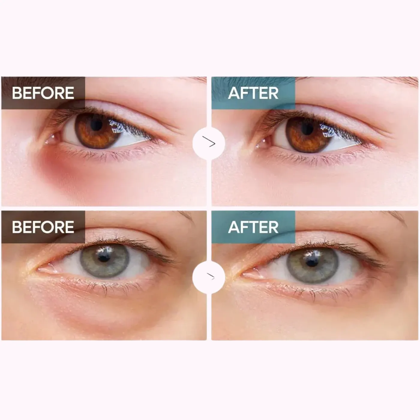 Dr. Melaxin TX Resinalsome Double Effect Eye Cream 40g - Vaizdas 3