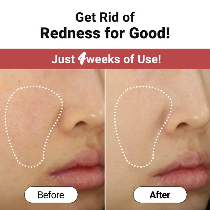 Troubless CLEAR REDMARK SOOTHING FACIAL SHEET MASK - Image 2
