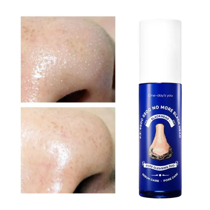 One days you P.Z Ssoc Ssoc No More Blackhead 100ml - Image 3