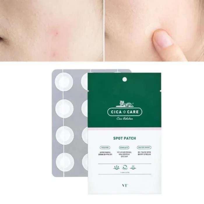 VT Cosmetics Spot Patch 48pcs - Image 2